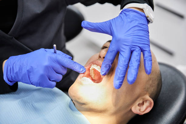 Best Emergency Wisdom Tooth Extraction in Nneconne, WI